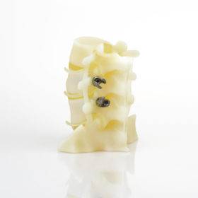 Spine Implants 1 - BioMimics